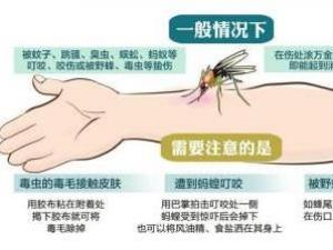 被毒蚊子咬了怎么辦？蚊子咬了怎么消腫止癢