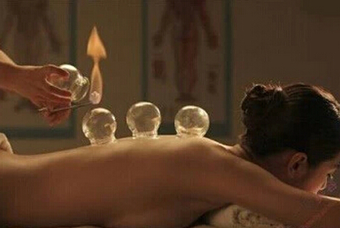 拔火罐能減肥嗎？拔火罐減肥的壞處