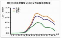 尿樣檢測可查乳腺癌