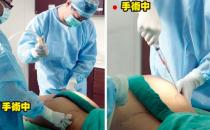 女性吸脂瘦腰有哪些疑問(wèn)