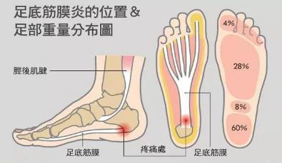 湛江崇愛(ài)康復(fù)醫(yī)院科普如何防治肌筋膜炎 以真誠(chéng)來(lái)服務(wù)患者