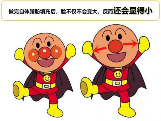 韋元強(qiáng)講解：瘦子也適合做自體脂肪填充嗎？