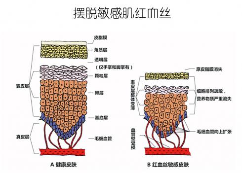 放心！有美薏升修復(fù)敏感肌紅血絲專家產(chǎn)品在，你每天都可以美美噠